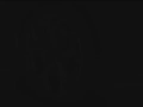 هولٹس - إصلاح الثقوب 300 مل - ميكرو سيارات المدينة / مقطورات / دراجات نارية